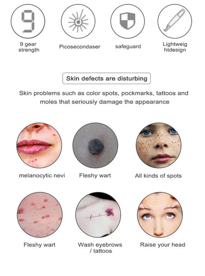Picosecond Laser Pointer for Mole Removal  Dark Spot Removal Pen tattoo Acne Skin Pigment Portable Removal Machine Beauty Device